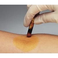 Carefusion #260619, APPLICATOR BENZOIN TINC 200/BX 10BX/CA Image