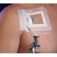 Centurion #SV40XT, DRESSING, IV, TRANSP, 4"X4.75", SORBAVIEW L, EACH Image
