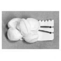 Teleflex #200334, SPONGE, TONSIL, LG, GAUZE, STERILE, 500/BX Image