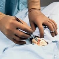 Ansell Healthcare #5788007, GLOVE, SURG, LATEX, ENCORE, ORTHOPEDIC, PF, 9, 50 PR/BX Image Ansell Healthcare #5788007, GLOVE, SURG, LATEX, ENCORE, ORTHOPEDIC, PF, 9, 50 PR/BX Image