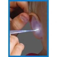 Bionix Medical Technology #2207, Curette Versaloop Lighted 200/BX Image Bionix Medical Technology #2207, Curette Versaloop Lighted 200/BX Image