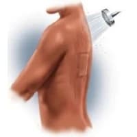 MPM Medical #MP00084, Dressing Repel 6x6" Composite Absorbent Non Adherent 30/Bg Image MPM Medical #MP00084, Dressing Repel 6x6" Composite Absorbent Non Adherent 30/Bg Image