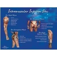 Nasco #LF00696U, Chart Intermuscular Injection Site Laminated 10-1/2x14" Ea Image Nasco #LF00696U, Chart Intermuscular Injection Site Laminated 10-1/2x14" Ea Image